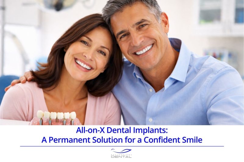 All-on-X Dental Implants: A Permanent Solution for a Confident Smile